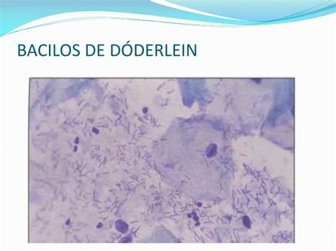 bacilos de doderlein-1